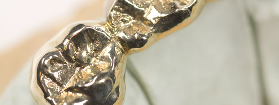 東京都港区青山の歯医者 ゴールド