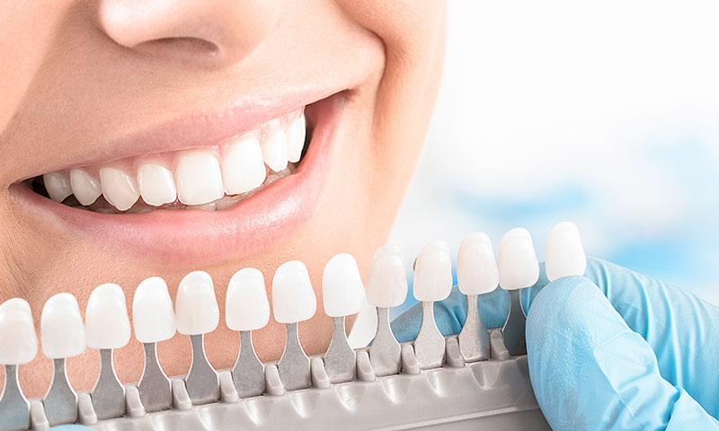 東京都港区青山の歯医者 ハイブリッドセラミックス