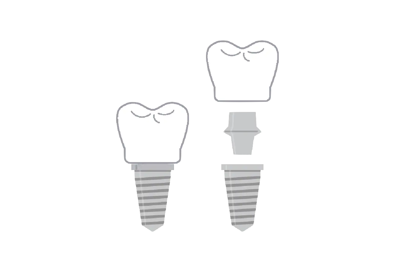 東京都港区青山の歯医者 インプラント