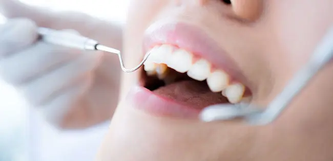 港区青山にある青山一丁目の歯医者 保険診療