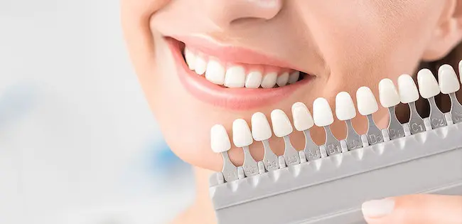 港区青山にある青山一丁目の歯医者 ホワイトニング