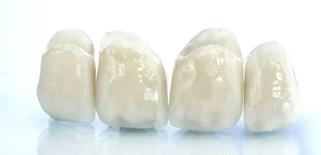 港区青山にある青山一丁目の歯医者 オールセラミック